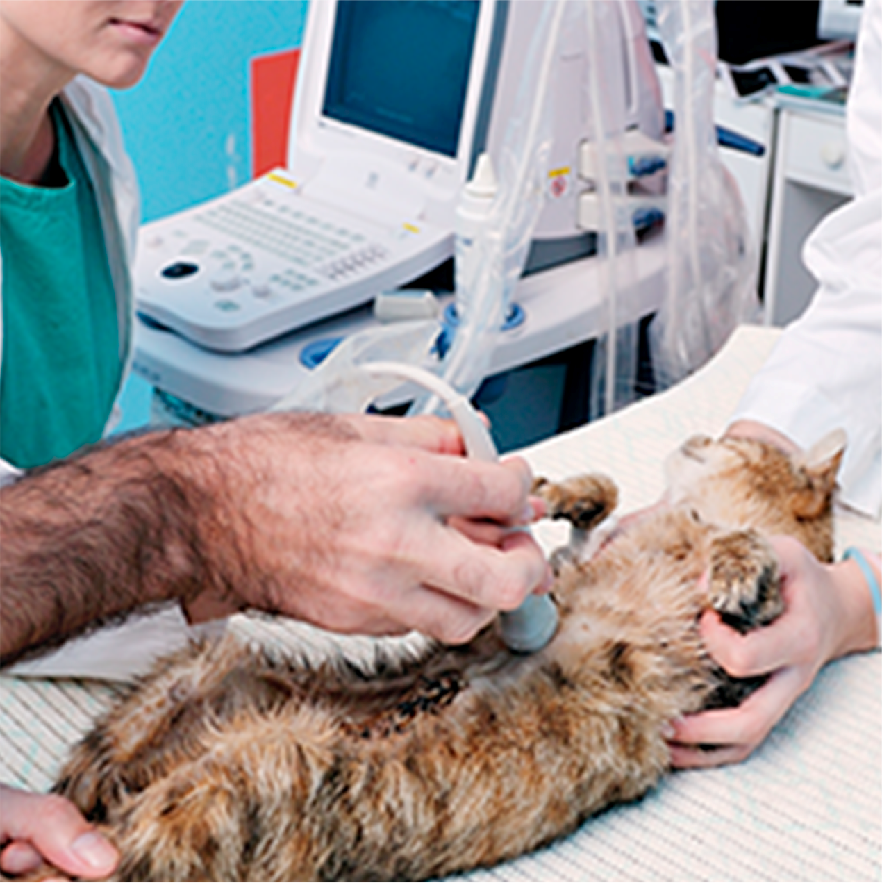 Ecocardiograma